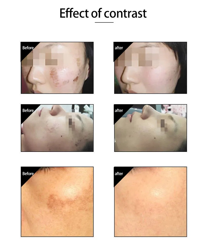 Hot Cold Hammer Skin Cool Lifting Cryotherapy